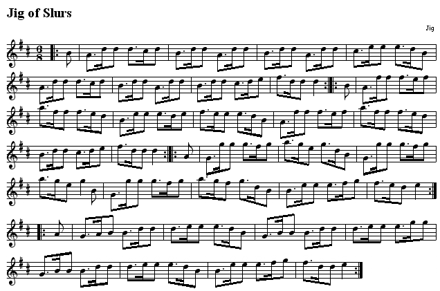 http://www.celticscores.com/file/474_Jig_of_Slurs.gif
