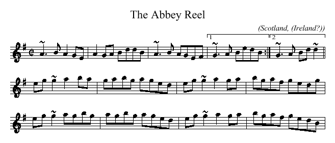 http://www.slowplayers.org/Music/gif/Abbey_reel.gif